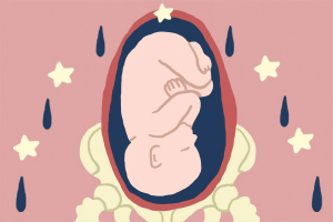Ilustración de un feto en posición de parto